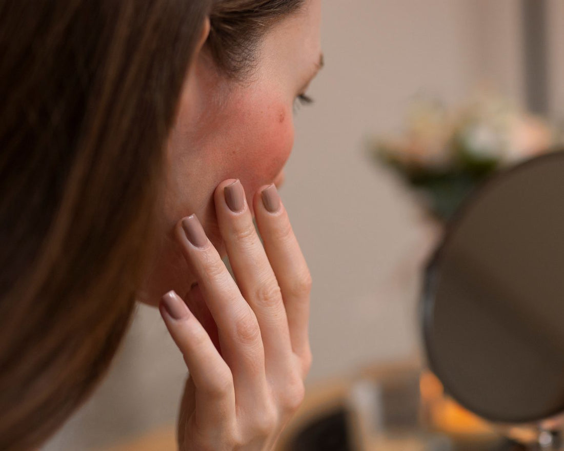 O que a sua pele quer dizer sobre a Rosácea?