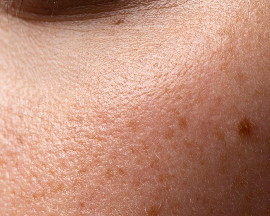 A opacidade inevitável: por que sua pele está sempre cansada (mesmo depois de 8 horas de sono)?